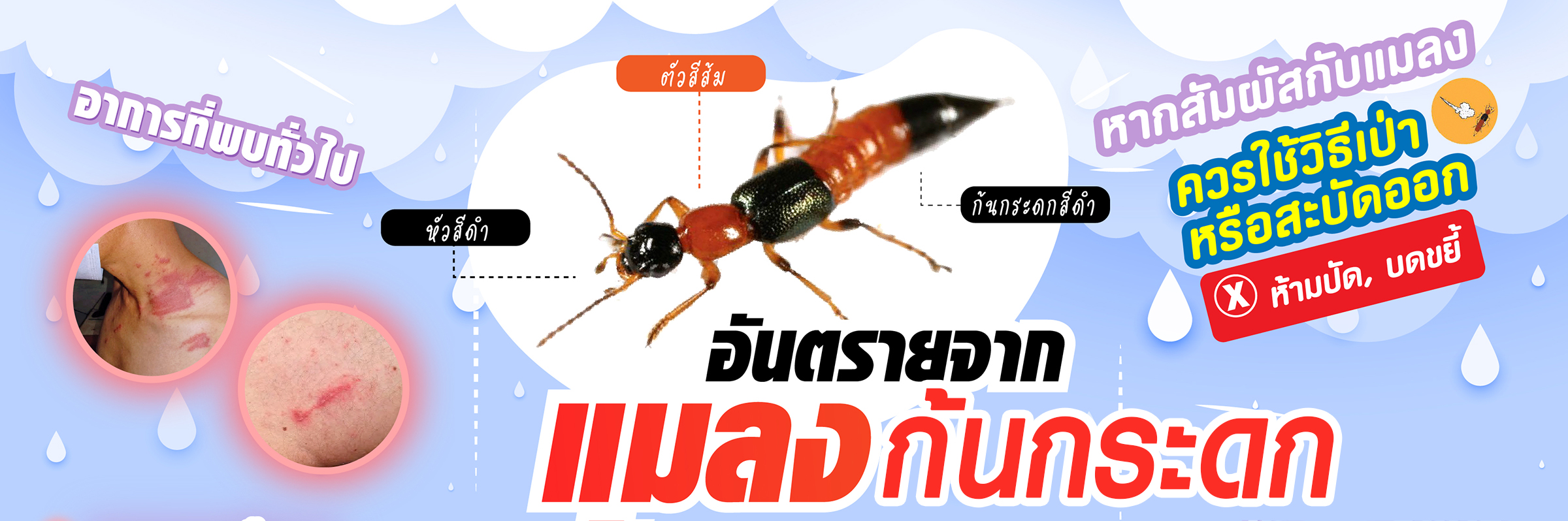 อันตรายจากแมลงก้นกระดก พิษร้ายในฤดูฝน